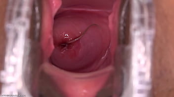 Bentley reccomend seeing process cumming pussy endoscopy