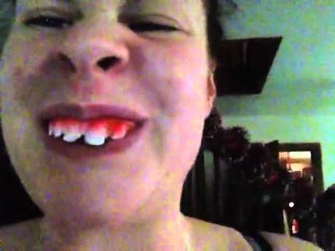 Girl with fucked up teeth